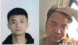 少年熬夜吃瓜秃头,少年为何一夜之间秃头？揭秘熬夜与脱发之谜